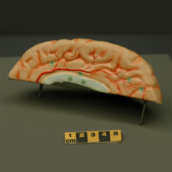 Représentation 3D d’une partie d’un cerveau humain féminin