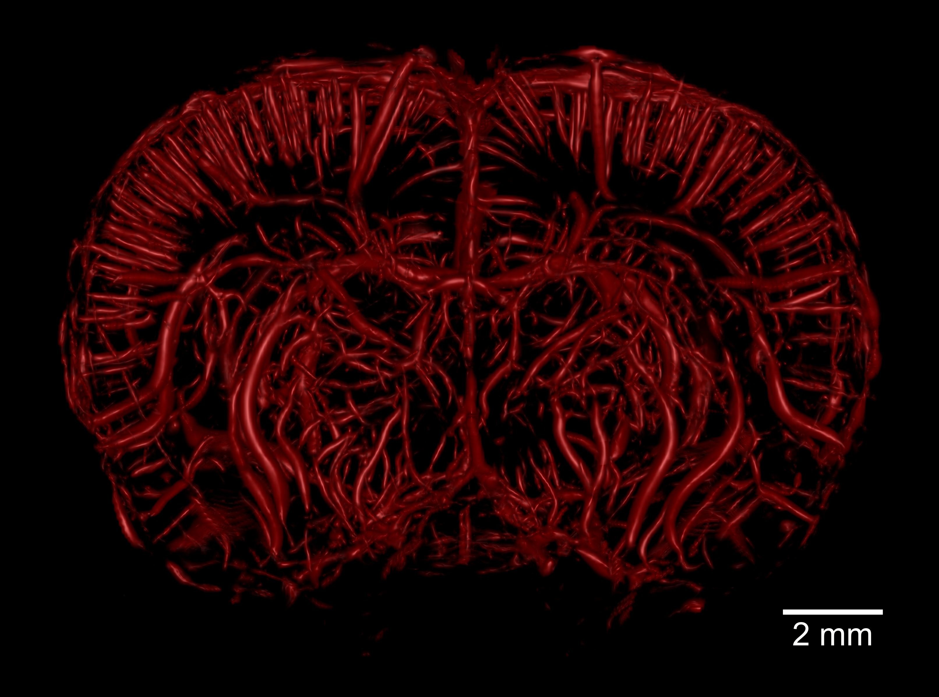 Reconstruction 3D de l'arbre vasculaire cérébral d'un rat acquis en imagerie par résonance magnétique