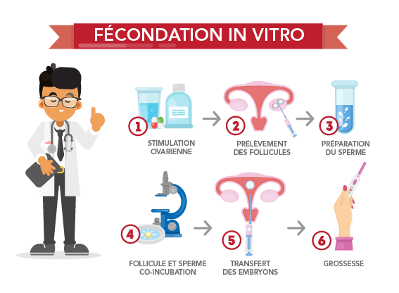 Les étapes de la fécondation in vitro 