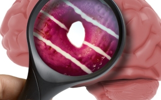 Cerveau humain analysé avec une loupe qui met l’accent sur l’image d’un beignet à l’intérieur de la lentille grossissante