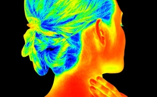 Image thermographique de la tête et du cou d'une femme
