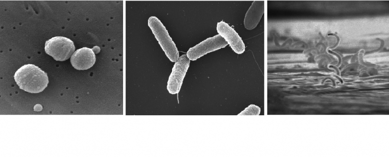 Electron microscope images of Streptococcus pneumoniae, Salmonella typhimurium and Treponema pallidum