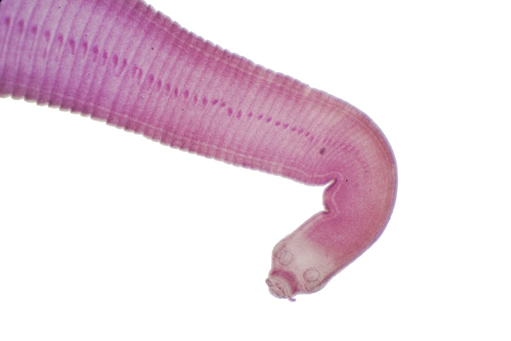 Microscope view of a tapeworm. On its head are hooks that let it latch on to the interior of an animal’s digestive system
