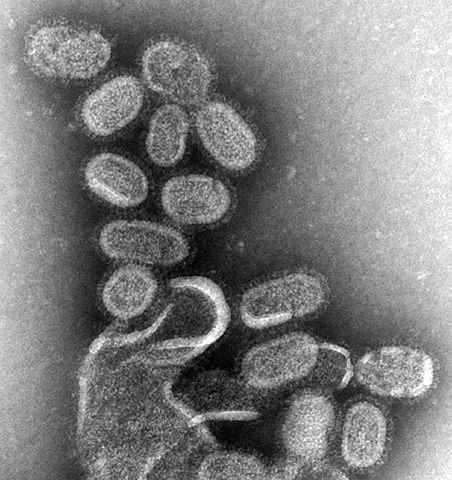Image au microscope électronique de virus influenza